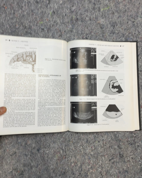 Ultrasonography: An Introduction to Normal Structure and Functional Anatomy by Reva Arnez Curry